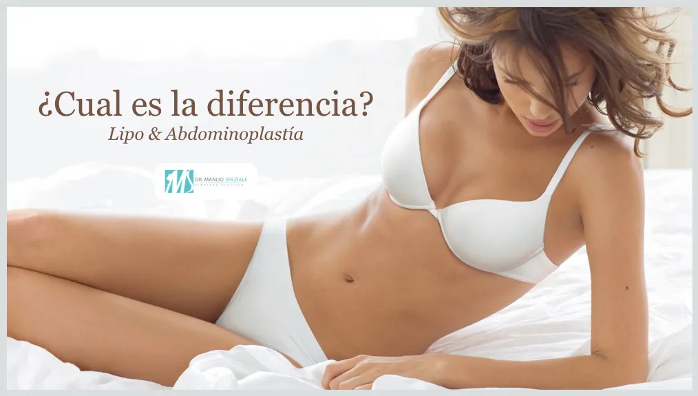 ¿Cual es cual? Diferencia entre Liposucción y abdominoplastía