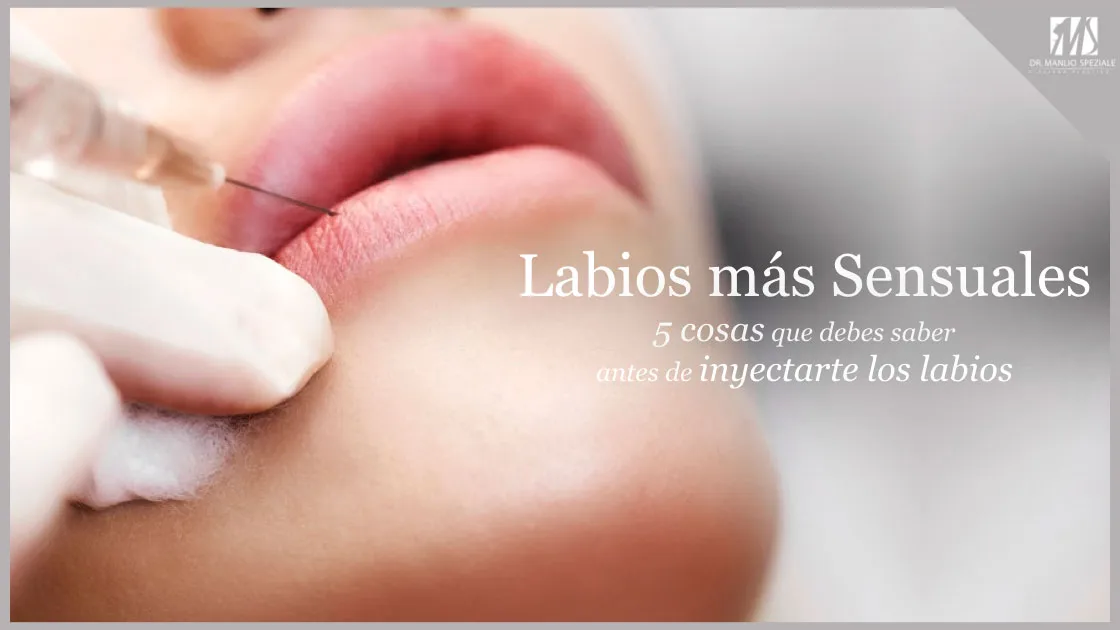 5 cosas que te gustaría saber antes de aplicarte Fillers en tus Labios